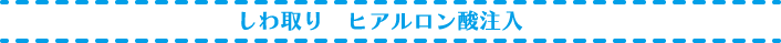 しわ取りヒアルロン酸注入