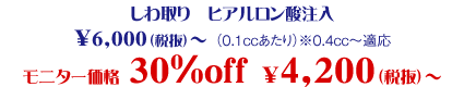 しわ取りヒアルロン酸注入 モニター価格 30%OFF