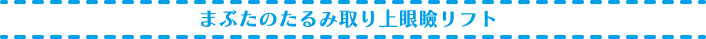 まぶたのたるみ取り上眼瞼リフト